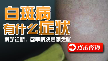 白癜风出现扩散会有哪些症状体现