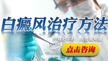 白癜风有什么好的治疗方法