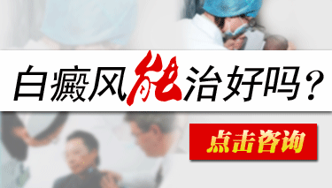 白癜风是能够治好的吗