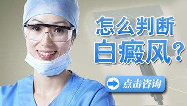 武汉白癜风该怎么诊断呢?